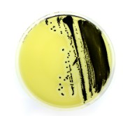 YEAST GLUCOSE CHLORAMPHENICOL AGAR (20)