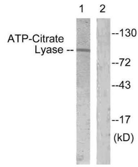 Anti-ATP-Citrate Lyase antibody produced in rabbit