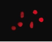 ANTICUERPO ANTI-8-OXOGUANINA, CLON 483,15