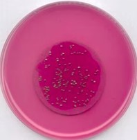 AGAR M-ENDO LES (500G)