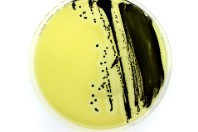 PLACA MUELLER HINTON II AGAR (SHEEP BLOOD 5%) (20)