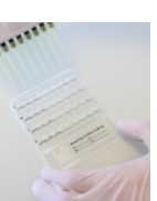 ComASP CEFIDEROCOL 0.008-128 (8TEST)