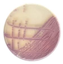 PLACA PREPARADA CROMOGENICA SALMONELLA 90 MM (20)