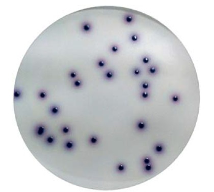 PLACA PREPARADA CHROMOGENIC COLIFORM AGAR 55 MM  