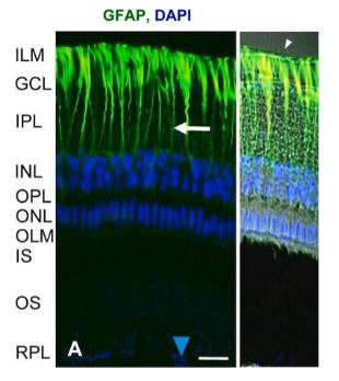 MONOCLONAL ANTI-GLIAL FIBRILLARY AC. PROTEIN