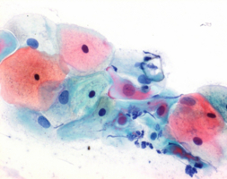 PAPANICOLAU (2b) ANARANJADO II (500)