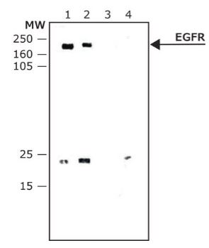 ANTI-EGFR (200UL)