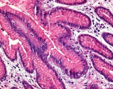 EOSINA G P/MICROSCOPIA (100)