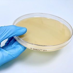 CHROMATIC BACILLUS CEREUS (10X140MM)